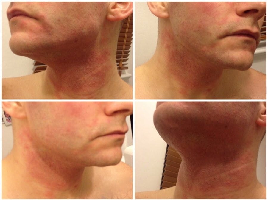 Why Your Skin Feels Irritated Even When You Use “Gentle” Products