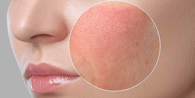Skin Is Not “Bad” — It’s Overloaded
