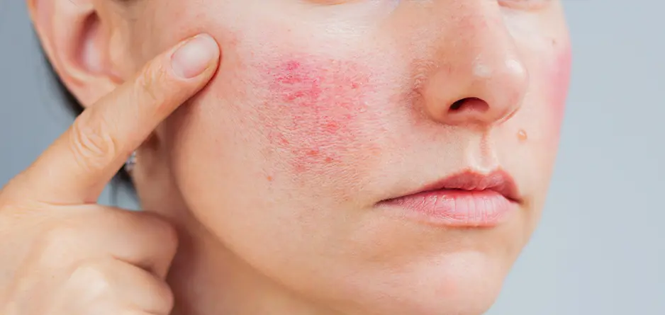 Skin Is Not “Bad” — It’s Overloaded